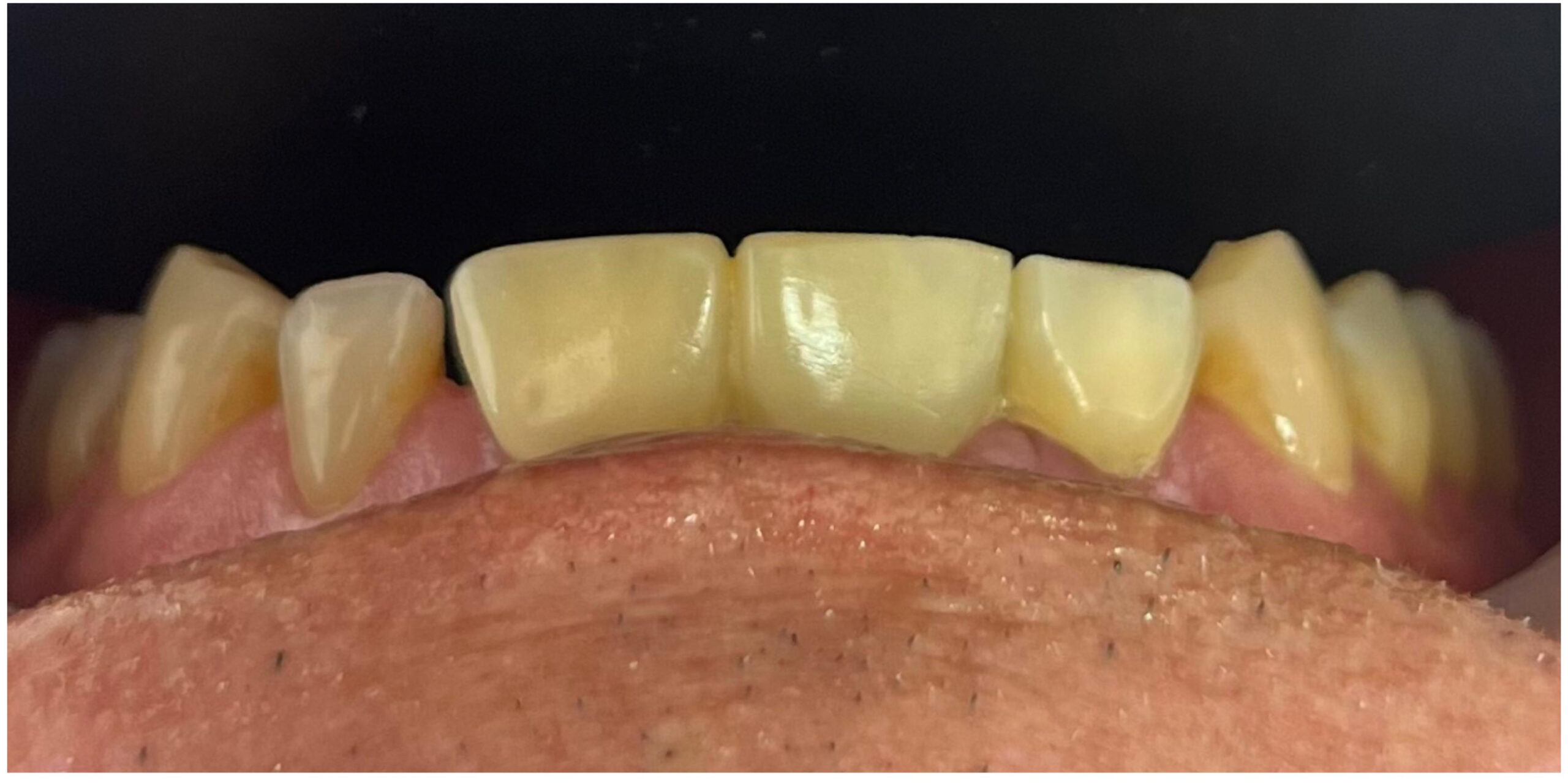 odontologia en pereira